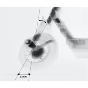 Segway eKickScooter E3 E 800 W Up to 25 km/h 10 "